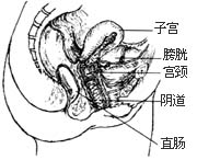 <em>阴道炎</em> 不要羞答答(图)