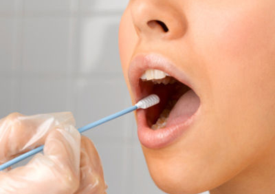 龋齿的致病原因和预防措施有哪些？