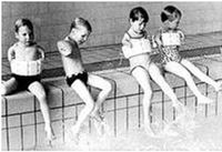 反应停引起的海豹肢