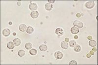 白细胞减少 白细胞减少