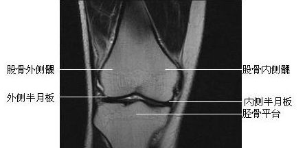 ϥ�ؽڹ�״��-MRI