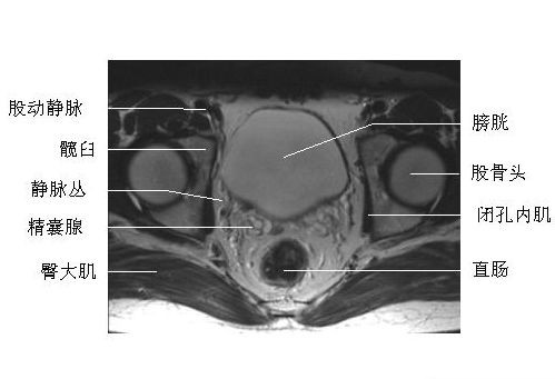������ǻ�����-MRI
