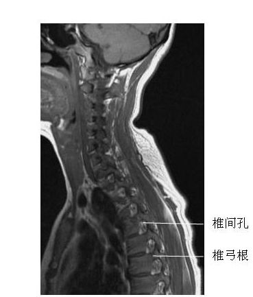 ��׵��ʸ״��-MRI