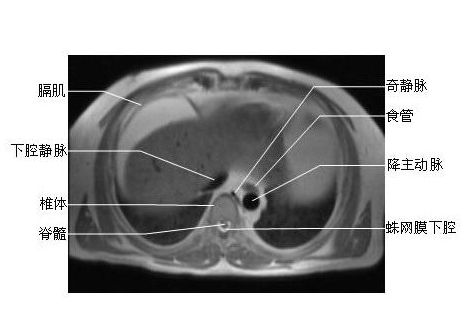 医学教育网 基础医学理论 医学图库 医学影像学图谱 mri(磁共振) 正文