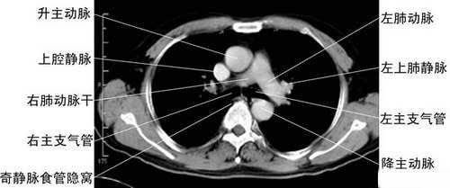 ���ֲܷ����-�ز�CT�ϲ�Ӱ��