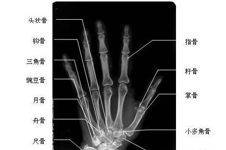 ����λ-X��