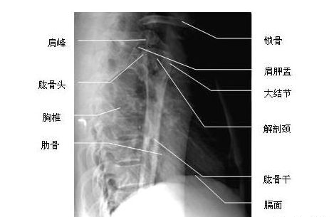 �Źǲ�λ-X��