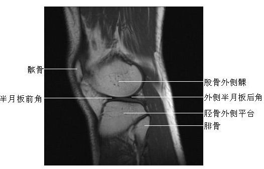 ϥ�ؽ�ʸ״��-MRIͼ
