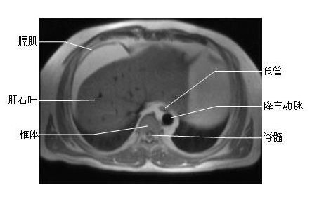 �ز������- MRIͼ