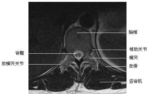 �ضκ����-MRIͼ