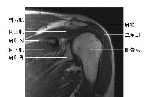 ��ؽڹ�״-MRIͼ