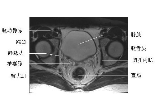 ������ǻ�����-MRIͼ