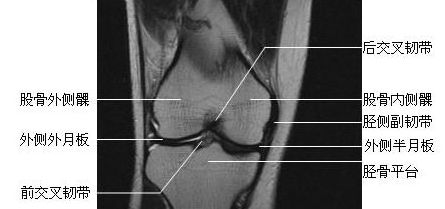 ϥ�ؽڹ�״��-MRIͼ