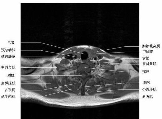 ͷ���������-MRIͼ