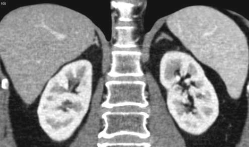 ���������ٹ�״λCT