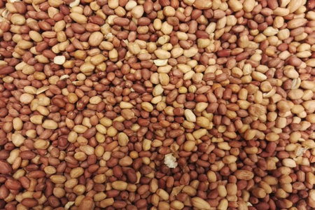 高脂血症诊断标准及分类