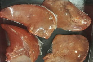 适合高血脂患者的食物和运动