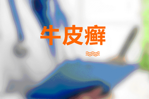中医预防牛皮癣要注意饮食和起居