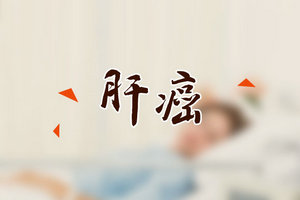 有助于确诊早期肝癌的常见检查方法