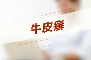 如何诊断牛皮癣?记住这3大临床特点!