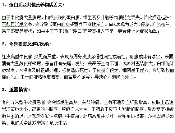 莫要忽视牛皮癣疾病，以下几种危害你了解吗？