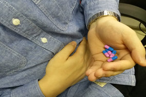 十二指肠溃疡穿孔的判定及治疗方法