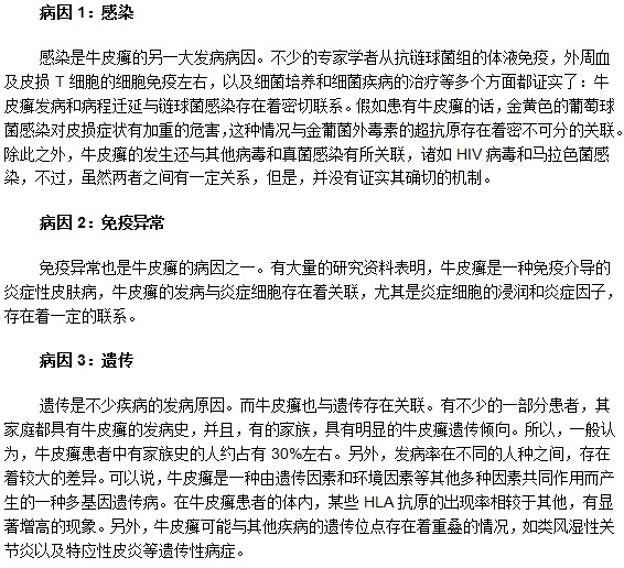 最常见的牛皮癣发病病因有什么？