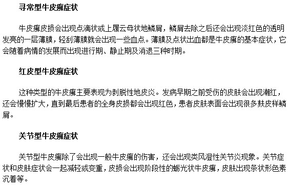 教你识别三种不同牛皮癣疾病的典型症状
