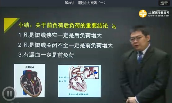 心力衰竭基本病因详细讲解