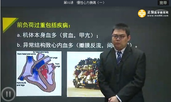 心力衰竭基本病因详细讲解