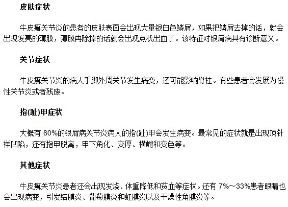 牛皮癣关节炎患者有哪些显著的特征