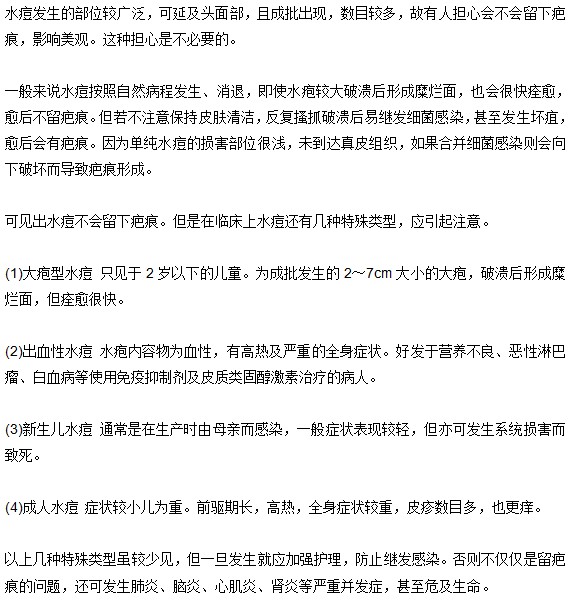 小儿水痘的分型