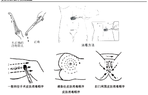 临床助理医师技能基本操作——手术区消毒,铺巾(附图片)