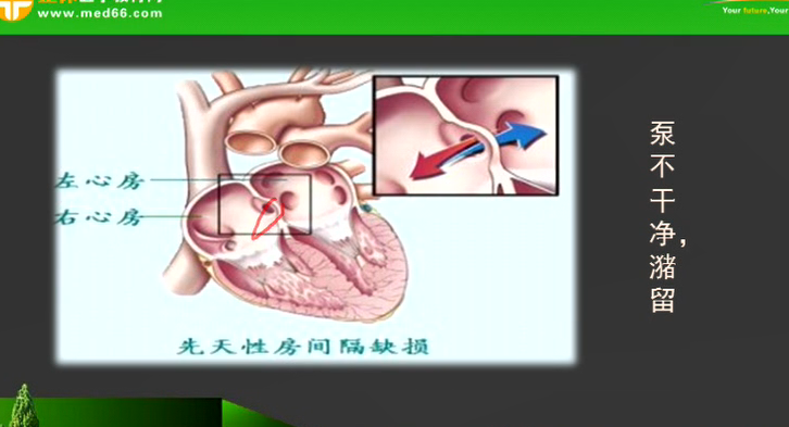 心脏的前负荷和后负荷