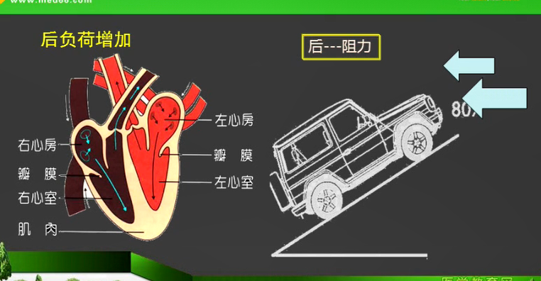 心脏的前负荷和后负荷