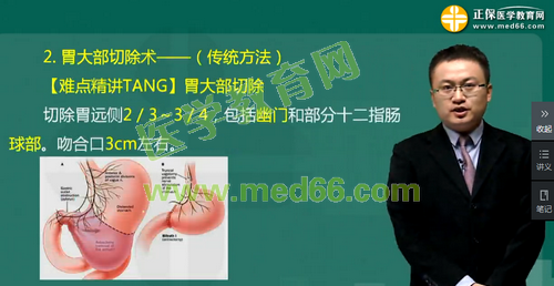 消化性溃疡考点