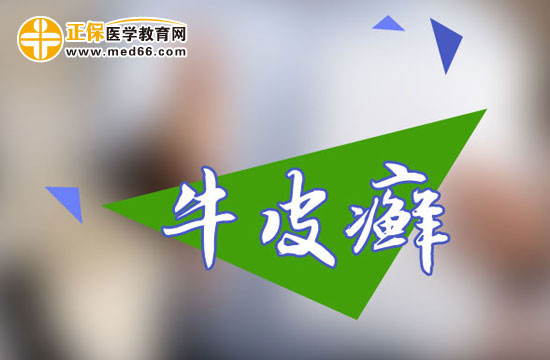 有关牛皮癣与生活习性的关系