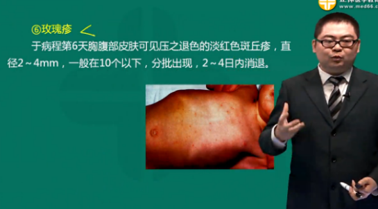 伤寒临床诊断标准