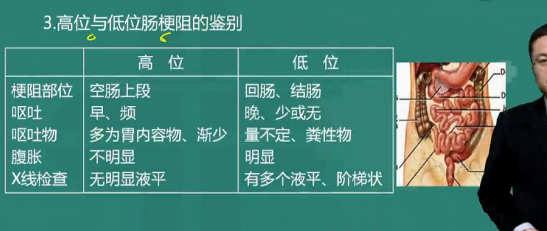 肠梗阻临床表现