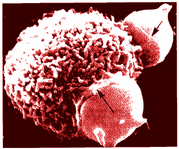 大吞噬细胞图片图片