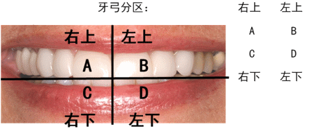 牙齿位置描述图 十字图片