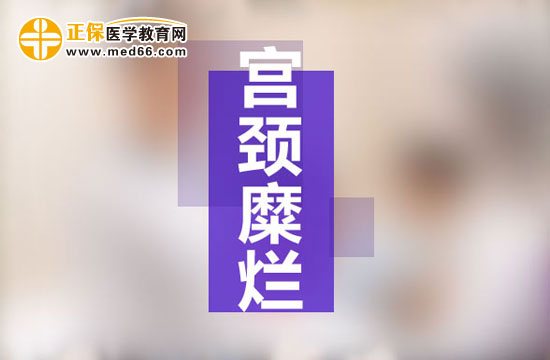 宫颈糜烂的临床表现 、治疗