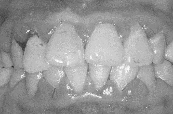 病例分析题口腔助理医师