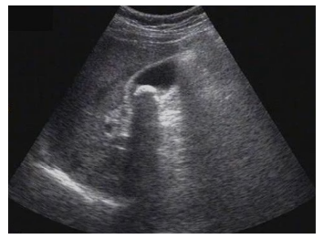 影像学3 影像学3