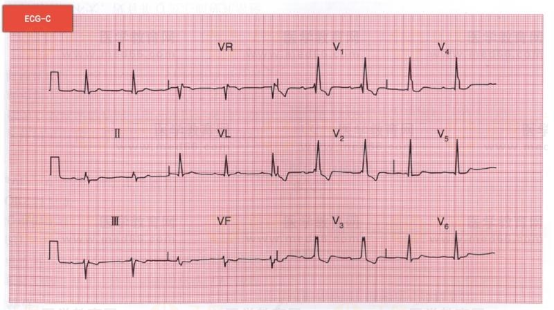 1492422386868-0_chg 1492422386868-0_chg