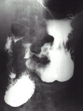 1492426372639-0 1492426372639-0