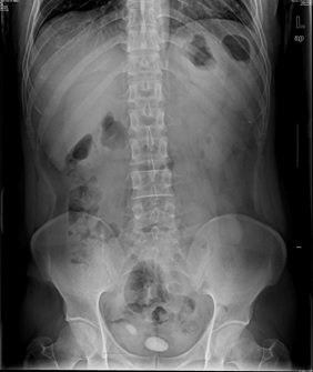 1492427224939-0 1492427224939-0