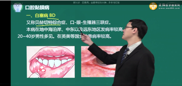 白塞病 白塞病