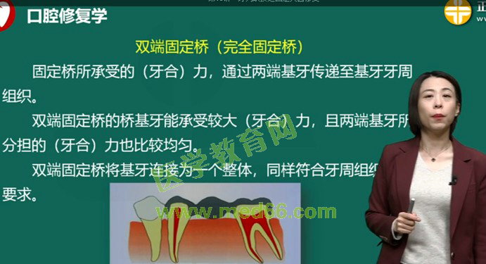 双端固定桥 双端固定桥