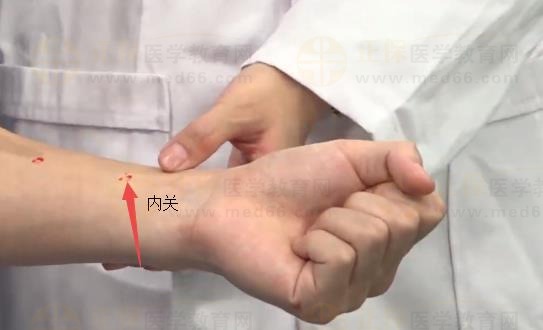 中西医助理医师实践技能针灸常用腧穴：手厥阴心包经（内关）